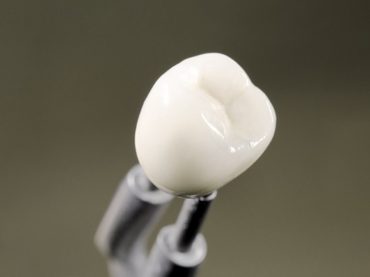 Zirconium Teeth