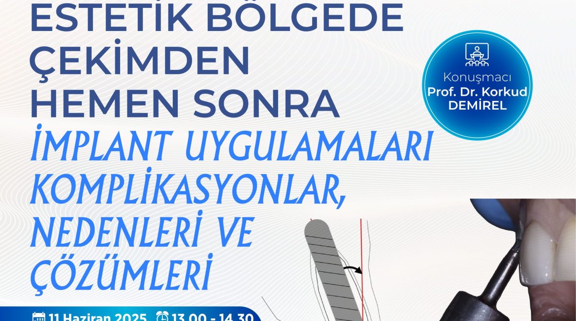 Estetik Bölgede Çekimden Hemen Sonra İmplant Uygulamaları Komplikasyonlar, Nedenleri ve Çözümleri