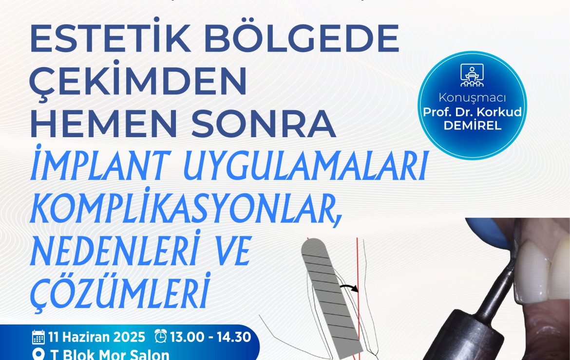 Estetik Bölgede Çekimden Hemen Sonra İmplant Uygulamaları Komplikasyonlar, Nedenleri ve Çözümleri